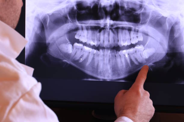 Best Weekend Emergency Dentist in Ponderosa Park, CO